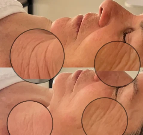 55F4428D-F3DC-4DC7-BF5F-66B11A9B6CA8