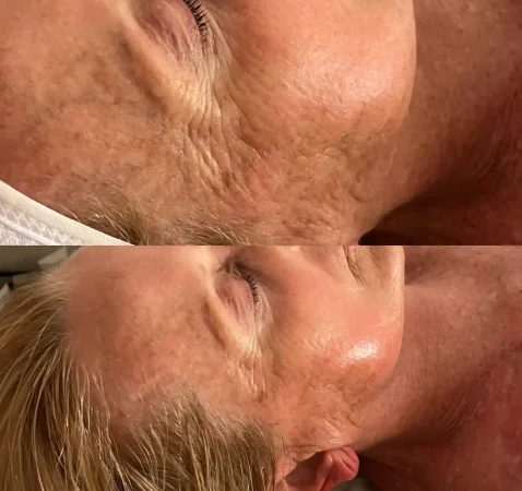 F1087D02-3D31-49FC-A675-A3AD5543FA03